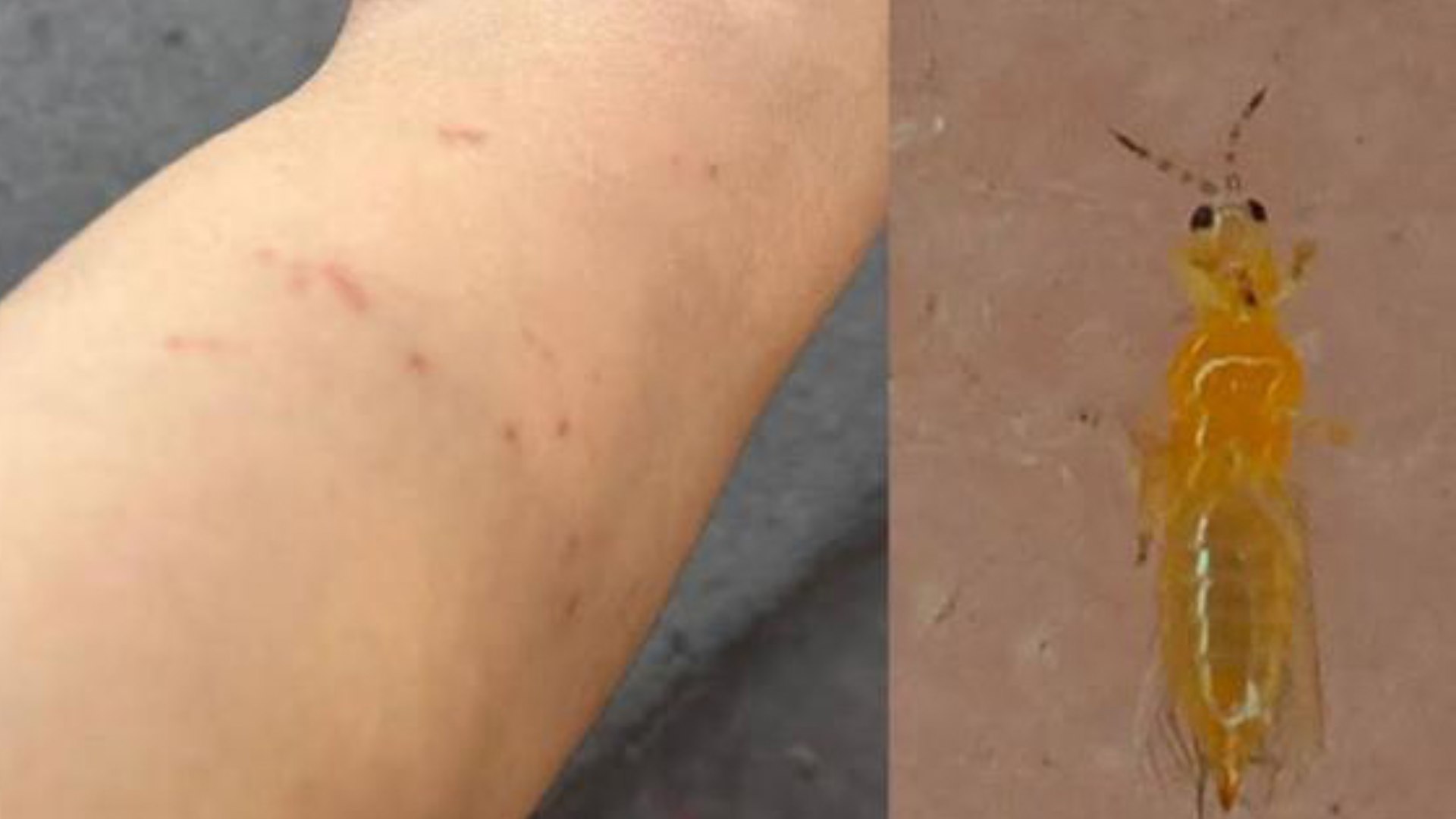 Descarta experto de UANL plaga de mosquitos en NL