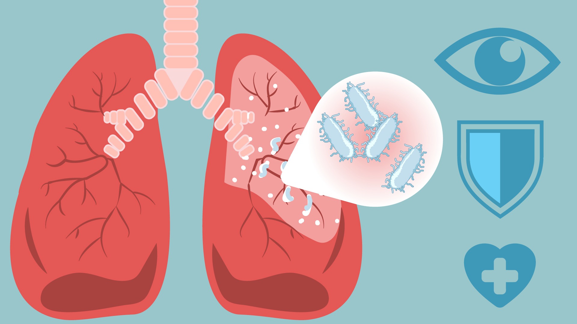 Piden precaución ante exposición a tuberculosis