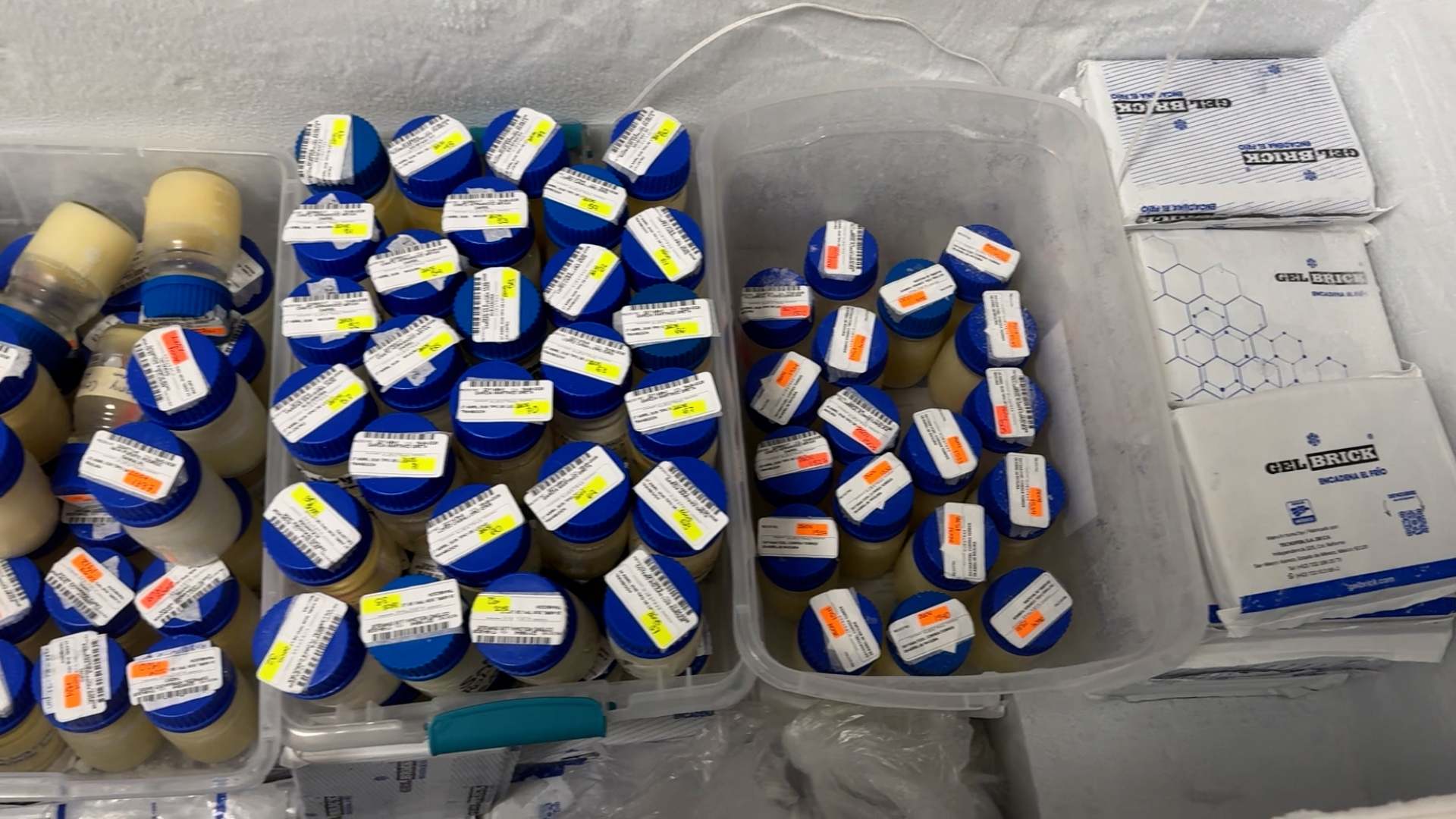Banco de leche humana del HU transforma vidas de bebés prematuros