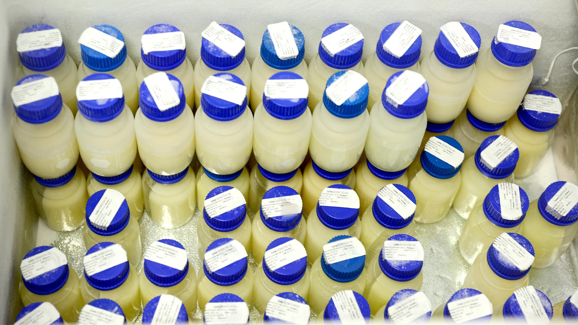 ¿De qué color es la leche materna?